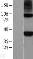 NODAL Protein (Over-Expression Lysate Myc-DDK (Flag))