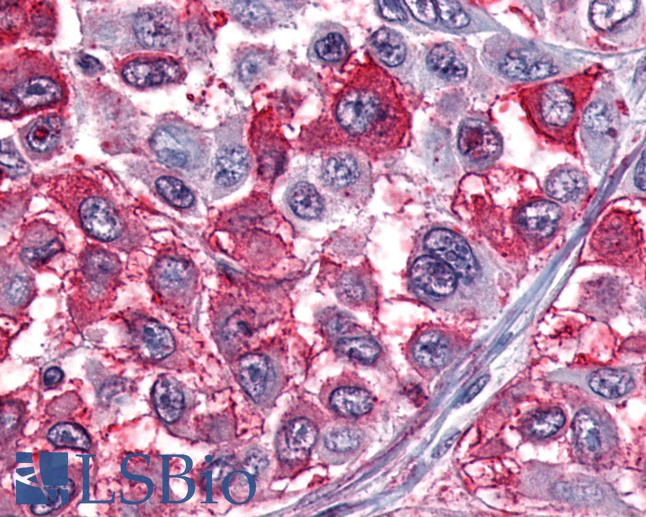 IHC-plus™ Polyclonal Rabbit anti-Human NPY1R Antibody (Extracellular Domain, IHC)