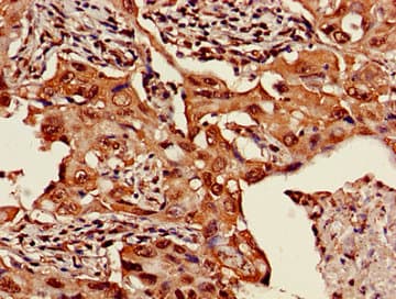 HIST1H3A Antibody