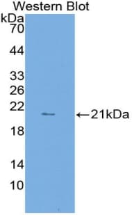 LAMP2 / CD107b Antibody (aa29-192)
