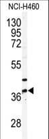 PANK3 Antibody (aa1-30)