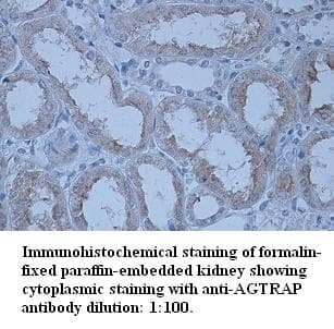 AGTRAP / ATRAP Antibody (C-Terminus)