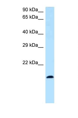 Polyclonal Rabbit anti-Human BST2 Antibody (N-Terminus, WB)