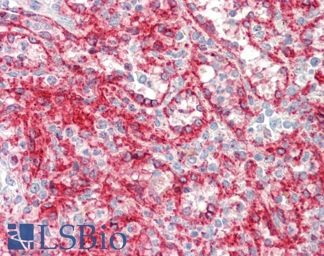 IHC-plus™ Monoclonal Mouse anti-Human HLA-A Antibody (aa70-99, IHC, WB)