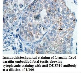 DUSP16 / MKP7 Antibody (aa70-249)