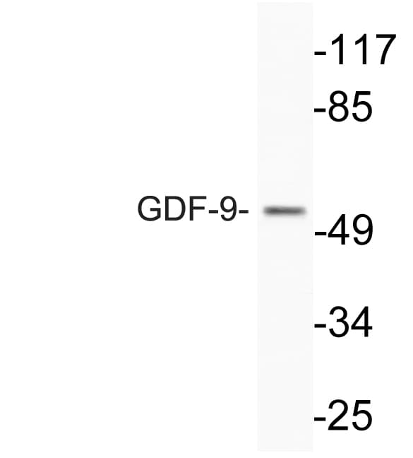 GDF9 / GDF-9 Antibody (aa273-322)