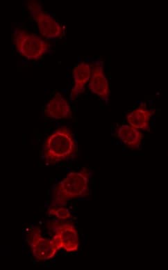 Polyclonal Rabbit anti-Human CPN1 Antibody (IF, WB)