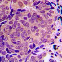 ALMS1 Antibody (Internal)