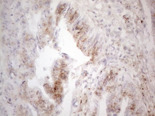 MME / CD10 Antibody (clone OTI2A6, Carrier-free)