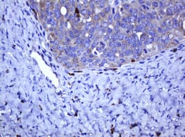 TCL / RHOJ Antibody (clone OTI2C11)