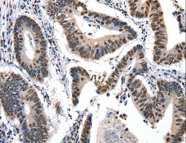 KLK7 / Kallikrein 7 Antibody