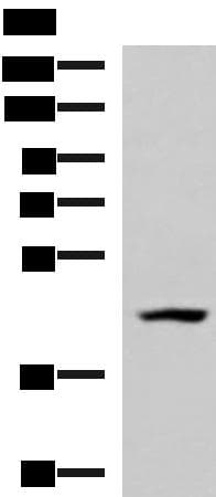 MAGEC2 / CT10 Antibody