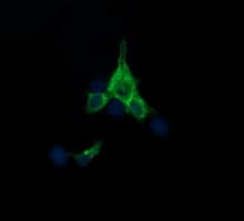 SYP / Synaptophysin Antibody (clone OTI1G3)