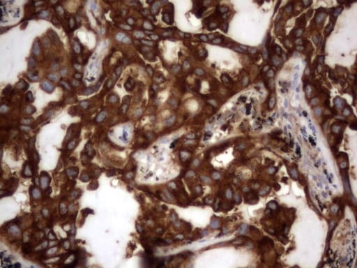 CEACAM5 / CD66e Antibody (aa35-680, clone OTI1D4)