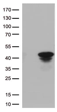 Monoclonal Mouse anti-Human CTSL / Cathepsin L Antibody (clone OTI1C7, aa114-333, IHC, WB)