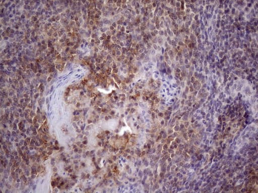 CD40 Antibody (aa21-166, clone OTI8G5, Carrier-free)