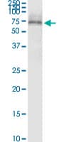 Monoclonal Mouse anti-Human SCTR / SR / Secretin Receptor Antibody (clone 3H1, WB)