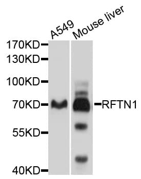 Polyclonal Rabbit anti-Human RFTN1 / Raftlin Antibody (WB)