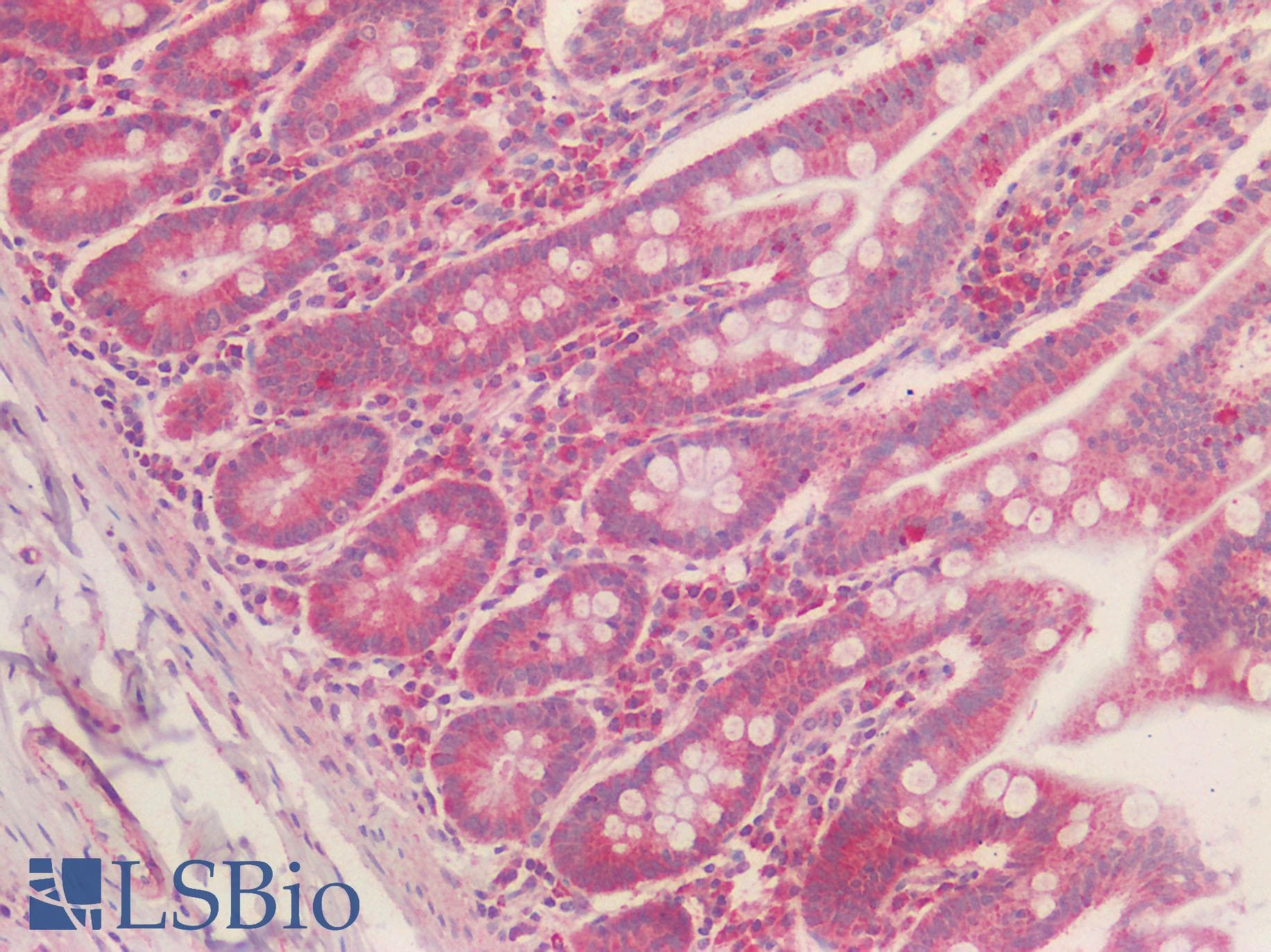 IHC-plus™ Polyclonal Rabbit anti-Human NALP3 / NLRP3 Antibody (Internal Region, IHC)