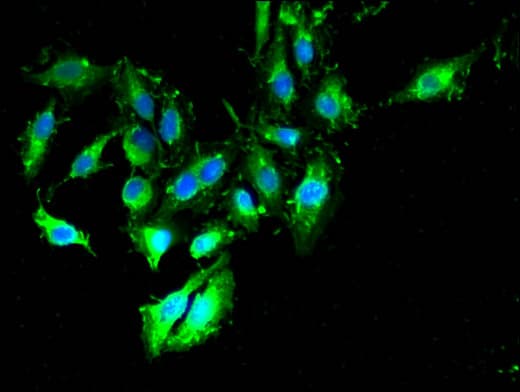 Polyclonal Rabbit anti-Human TIMD4 / TIM4 / TIM-4 Antibody (IF, WB)