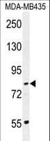 Polyclonal Rabbit anti-Human PCDHGA1 Antibody (aa287-315, IHC, WB)