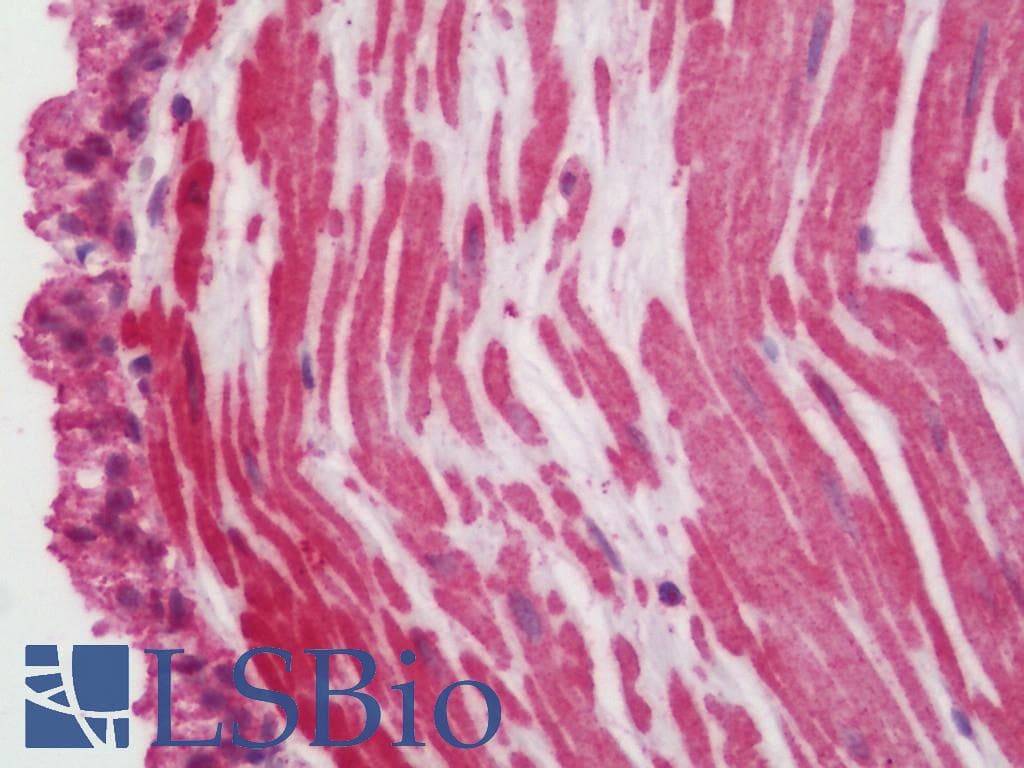 IHC-plus™ Monoclonal Mouse anti-Human Endothelin 3 / EDN3 Antibody (clone 2A6-2A4, IHC, WB)