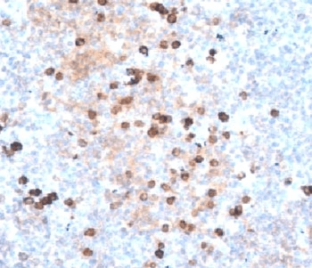 IgM Heavy Chain Antibody (clone IM373, Azide-free, BSA-free)