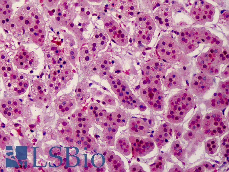 IHC-plus™ Polyclonal Rabbit anti-Human AURKB / Aurora-B Antibody (phospho-Thr232, IHC, WB)