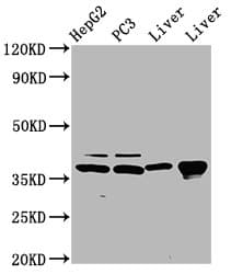 E2F5 Antibody