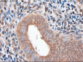 PTCH1 / Patched 1 Antibody (clone OTI5C7)
