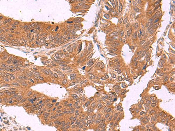 ZBTB33 / Kaiso Antibody
