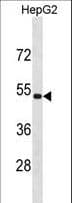 ZNF773 Antibody (aa108-137)