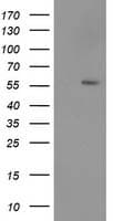 TP53 / p53 Antibody (clone OTI1D8)