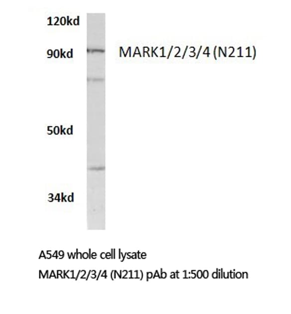 Polyclonal Rabbit anti-Human MARK1+2+3+4 Antibody (Asn211, IHC, IF, WB)