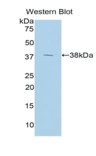 ARG1 / Arginase 1 Antibody (aa1-323)