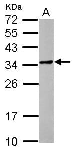 Polyclonal Rabbit anti-Human POMZP3 Antibody (WB)