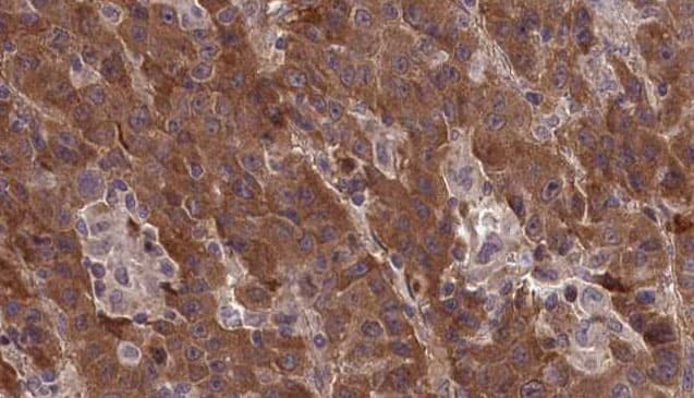 Polyclonal Rabbit anti-Human GRM1 / MGLUR1 Antibody (IHC, IF, WB)