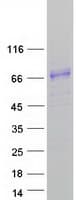 Human HHIPL1 Protein (Recombinant Myc-DDK (Flag))