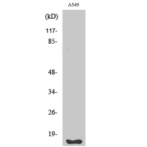 Polyclonal Rabbit anti-Human FHIT Antibody (60-140 aa, Internal, IHC, IF, WB)