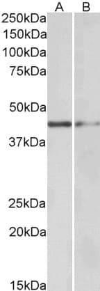 IHC-plus™ GATA3 Antibody (aa2-14)