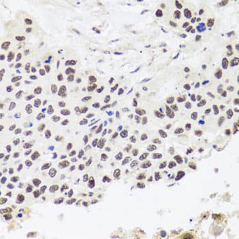 Polyclonal Rabbit anti-Human RPP30 Antibody (IHC, WB)