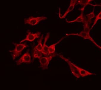ICAM-1 / CD54 Antibody (phospho-Tyr512)
