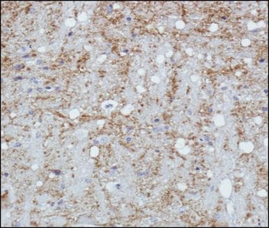 SYP / Synaptophysin Antibody (aa230-313)