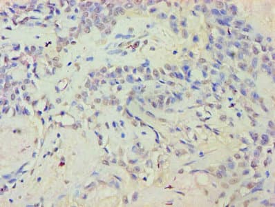 Polyclonal Rabbit anti-Human EYA2 Antibody (WB)