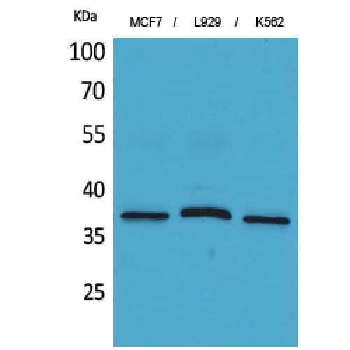 CD79B / CD79 Beta Antibody (61-110 aa, Internal)