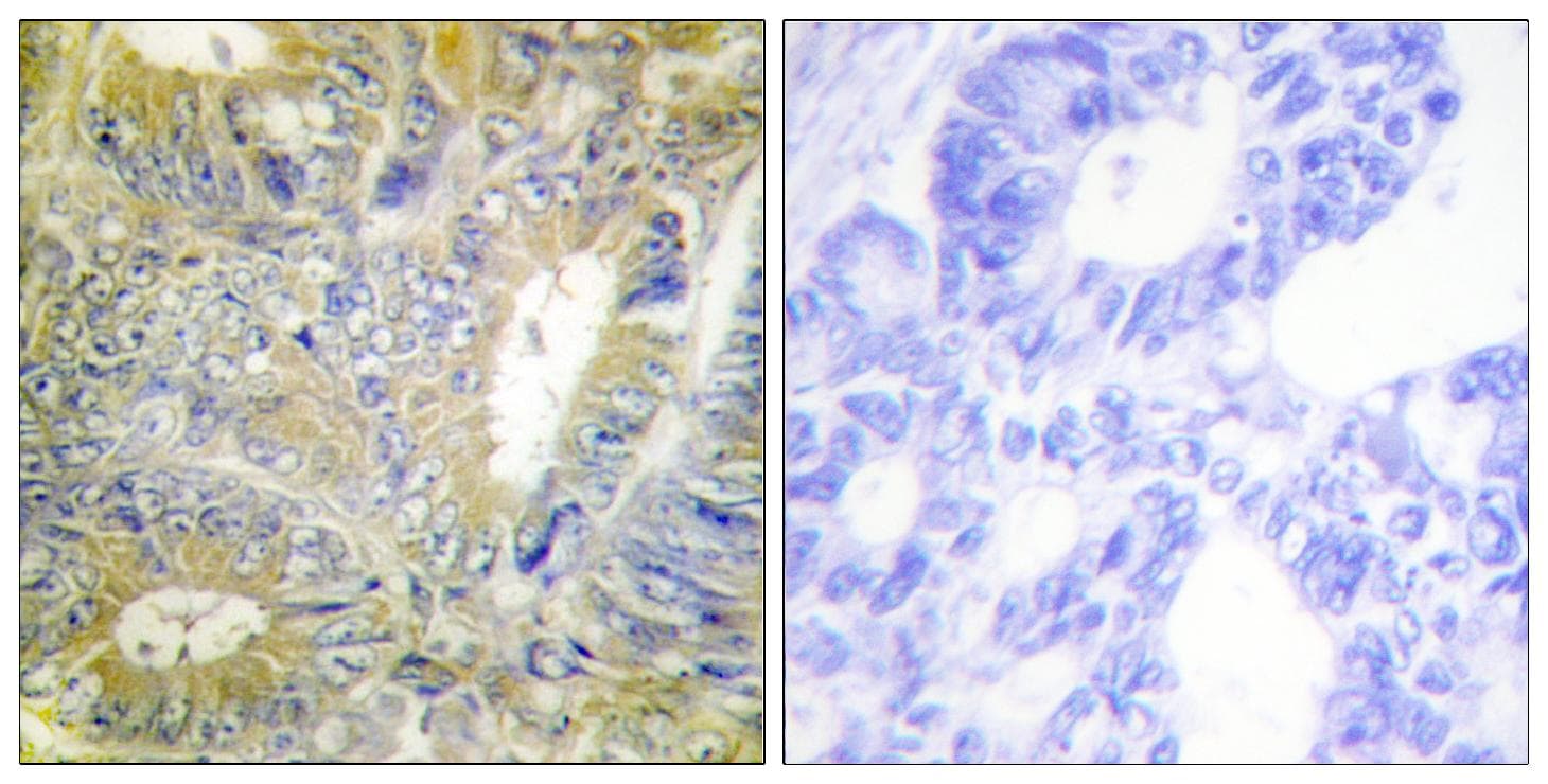 DES / Desmin Antibody (p60)