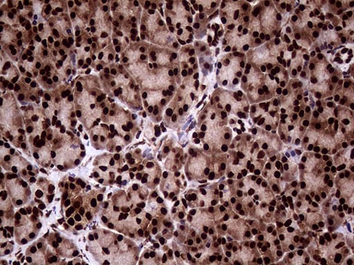 TALDO1 / Transaldolase 1 Antibody (clone OTI2E4)