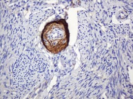 PARVB Antibody (clone OTI1B7)