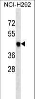 TBXT / T / Brachyury Antibody (aa201-228)