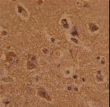 Polyclonal Rabbit anti-Human CTDP1 / FCP1 Antibody (aa247-276, IHC, WB)